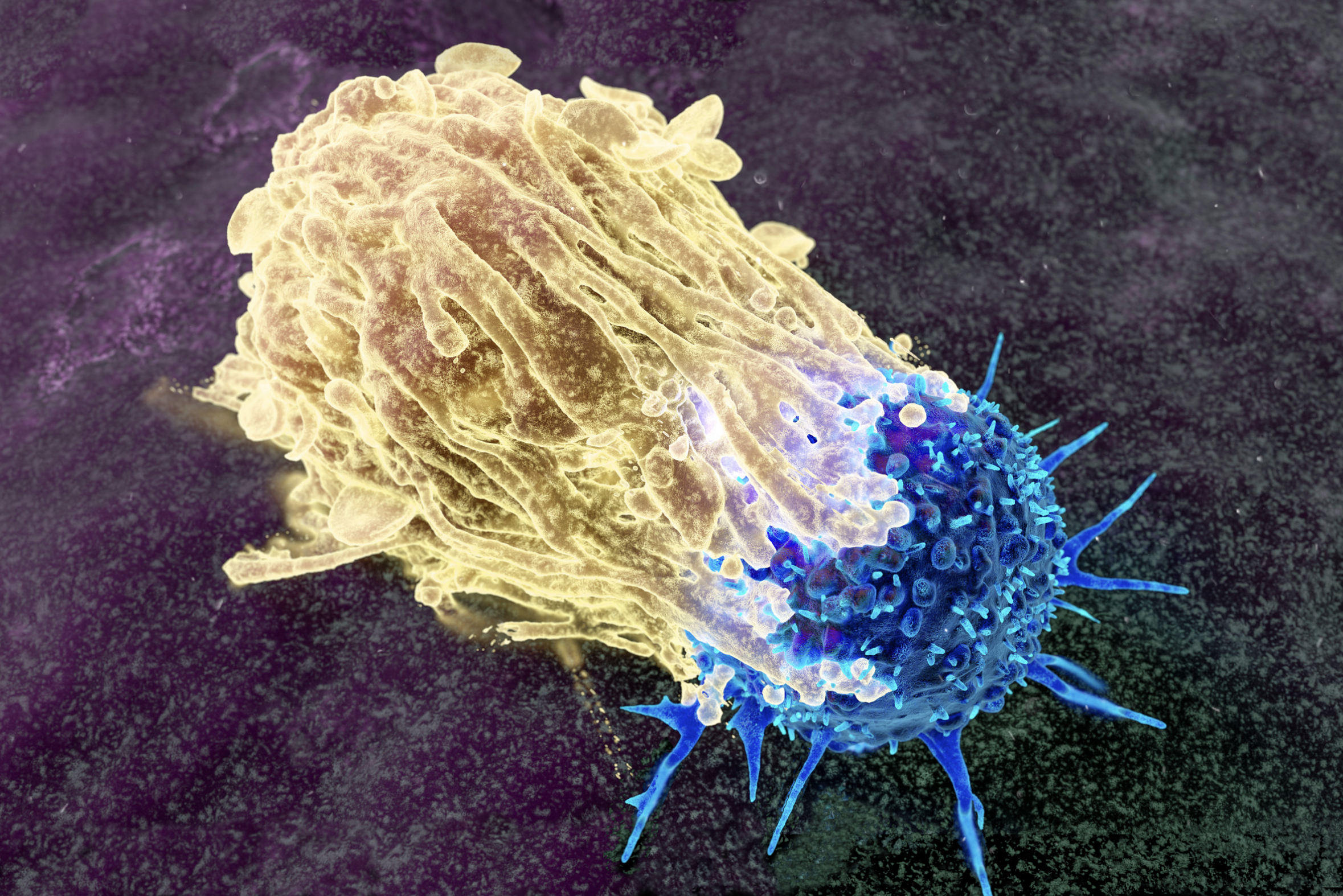 câncer de próstata